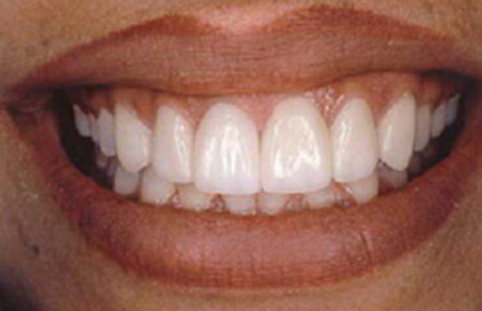 Patient's healthy teeth and gums after treatment