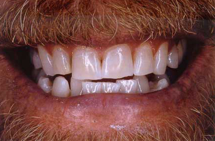 Man's smile with brilliantly white smile
